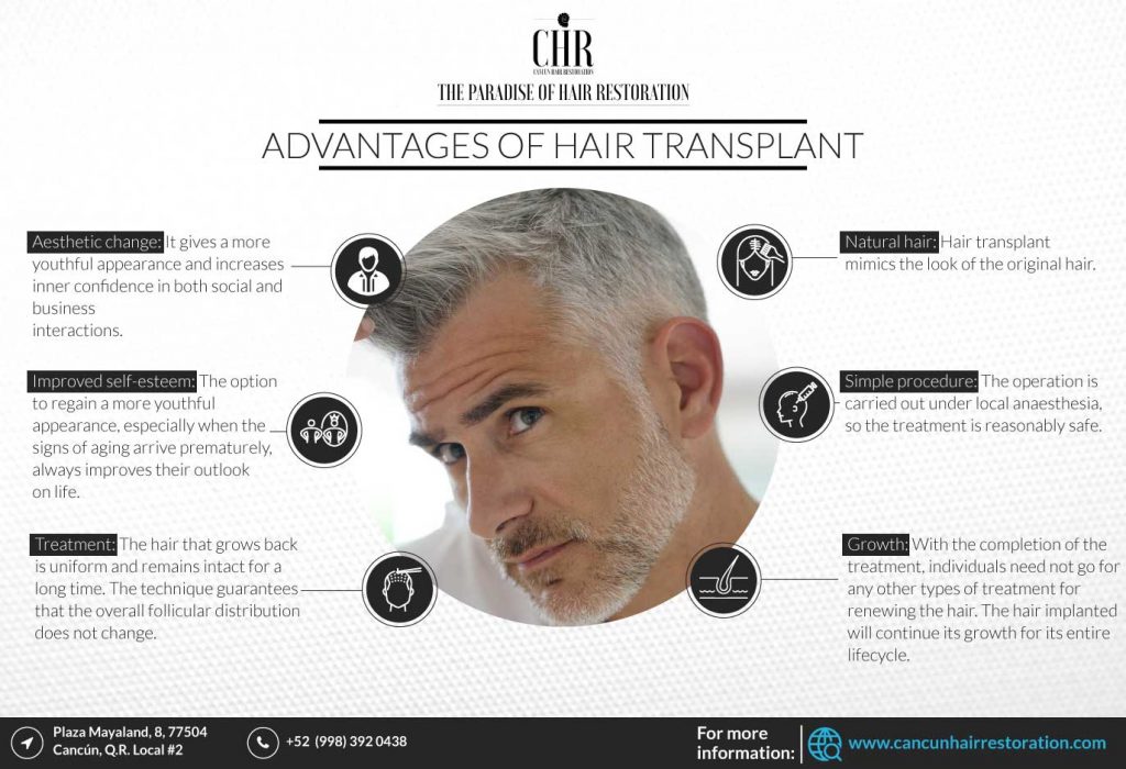 Infographic of the advantages of a FUT hair transplant