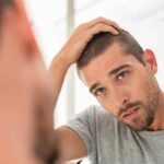 Man worried about having premature balding