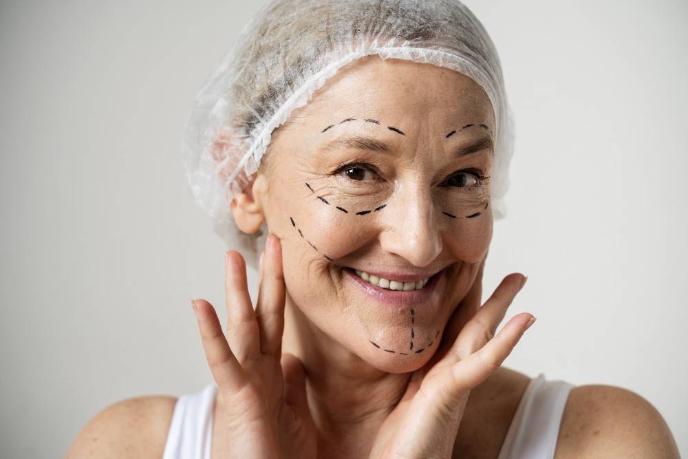 Woman with dotted lines for facial plastic surgery