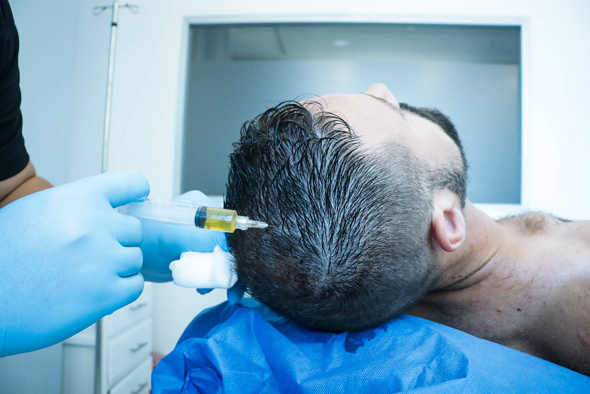 PRP Treatment Delray Beach- FL 33483 – Hair Restoration - Best Hair Loss  Treatment – PRP Injections Delray Beach - PRP Injections Boynton - PRP  Injections Boca Raton - PRP Injections Coconut