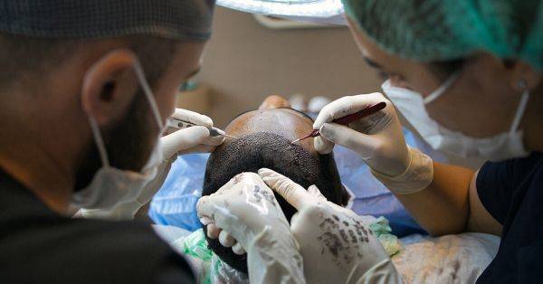 FUE implants; FUE hair transplant surgery