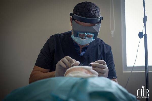 FUE hair transplant carried out in CHR
