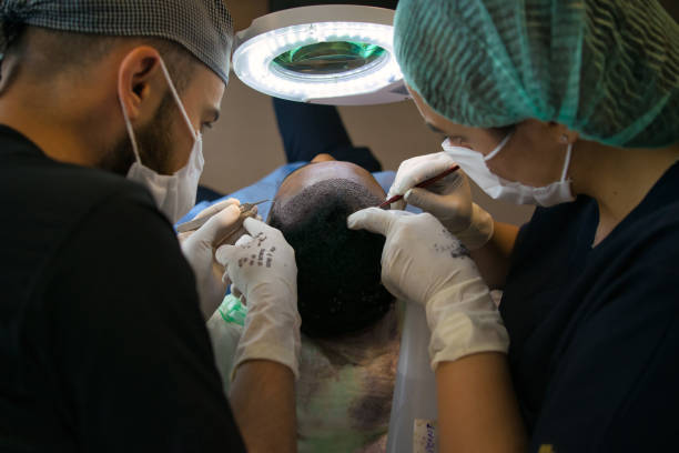 Cuánto cuesta un injerto de cabello; médicos trabajando en el injerto capilar