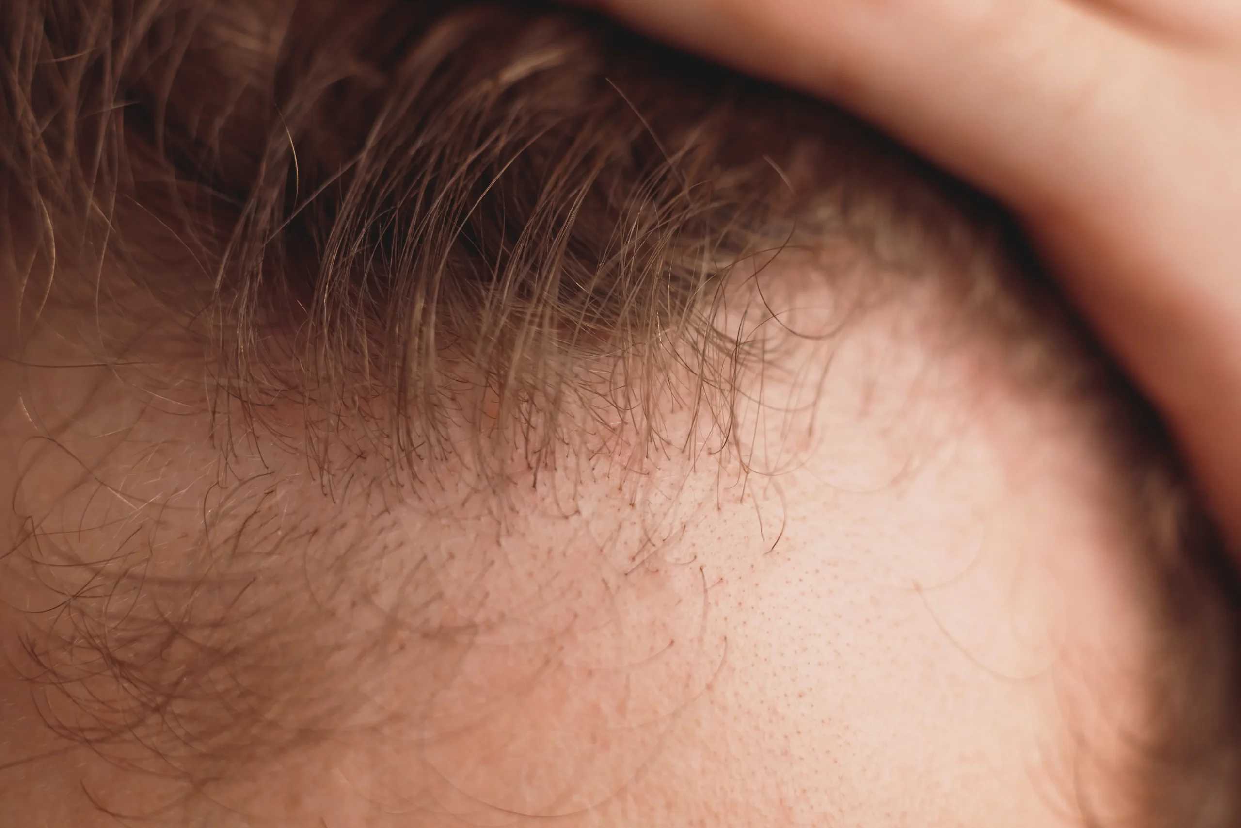 balding-man-is-opening-his-forehead-close-up-view-2023-11-27-05-00-41-utc