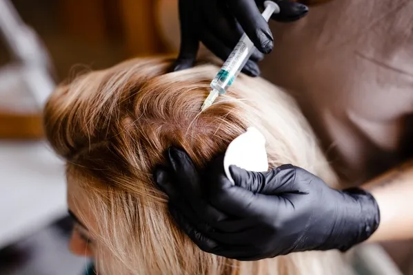 Médico esteticista especializado realiza inyecciones precisas en el cuero cabelludo de una paciente como parte de un procedimiento de injerto de cabello efectivo.