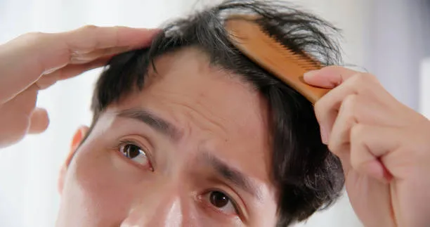 Young man styling his hair, demonstrating the gradual process of hair growth after hair transplant with natural results Name: hair-styling-hair-growth-after-transplant