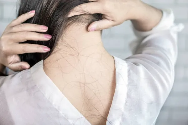 Back view of a young woman with long hair falling out as she notices the shedding effect, which is common after certain hair restoration treatments