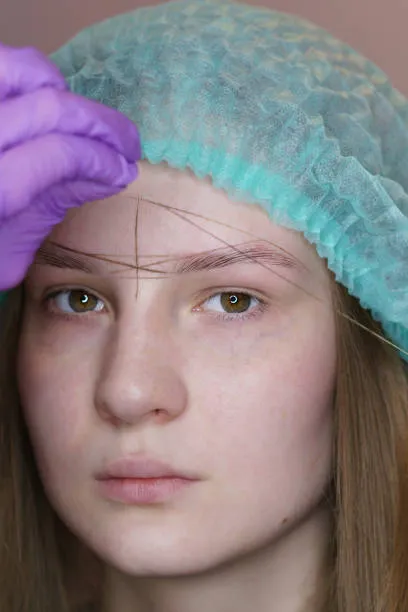 Female patient having her eyebrows measured and marked before eyebrow hair transplant to achieve symmetry and a natural-looking result