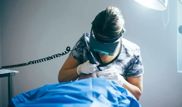 Doctora usando un punzón motorizado para extraer folículos de la zona donante durante el procedimiento de técnica capilar FUE