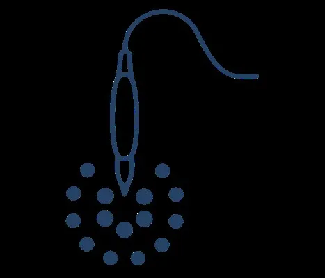 Ilustración de una aguja de micropigmentación creando puntos de pigmento en la capa superficial del cuero cabelludo.