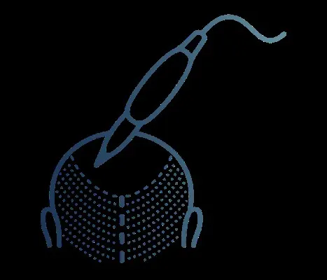 Ícono de una cabeza con el área superior cubierta de pequeños puntos, representando el resultado final de la micropigmentación.