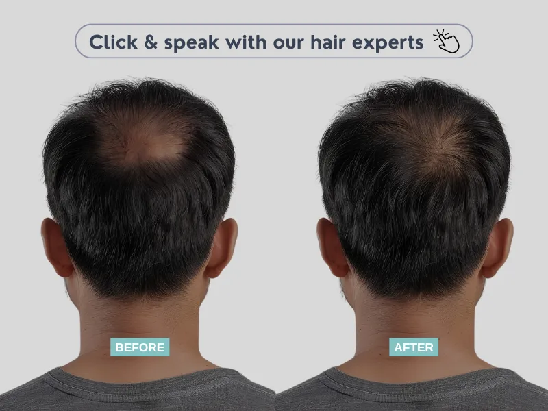 Banner de una comparación de como se veía un hombre antes y después ARTAS