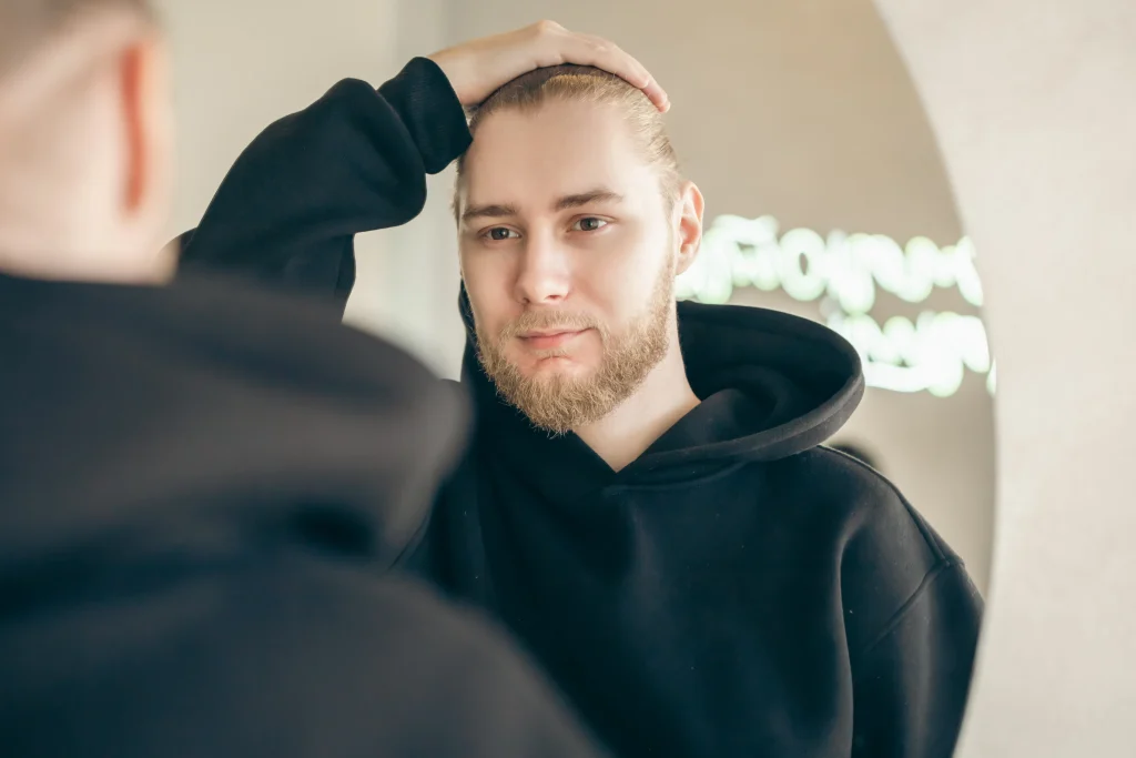 Man checking his receding hairline in a mirror. Can wearing hats cause hair loss or accelerate premature baldness?
