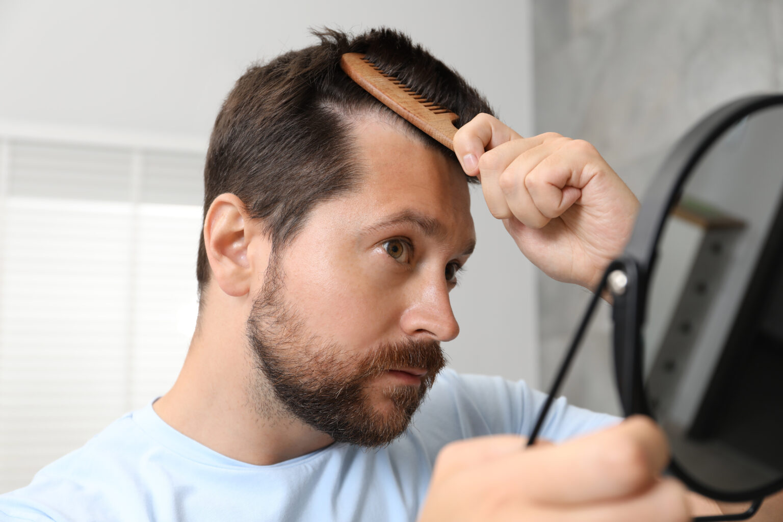 Does Hair Transplant Last Forever?