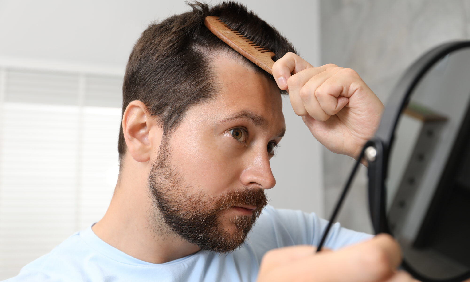 A man combs his hair in front of a mirror, wondering does hair transplant last forever to maintain his hairline.