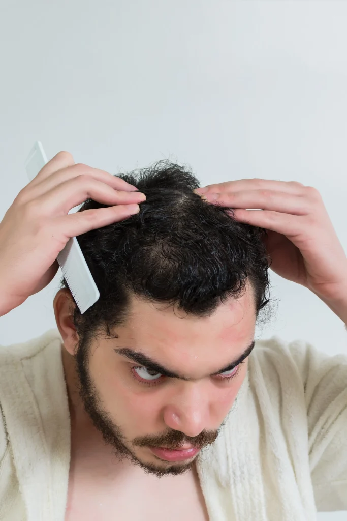 A concerned man examines his thinning crown area and asks does hair transplant last forever to fix hair loss.