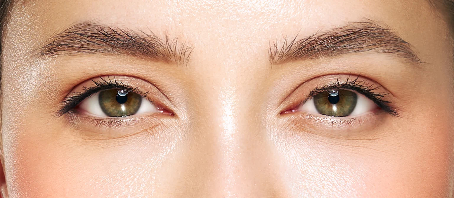 Eyebrow hair transplant for thin brows: is it the right permanent solution?