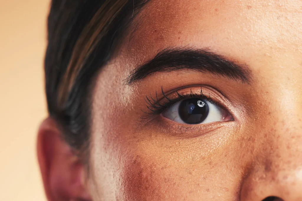 Close-up of a thick, well-defined dark eyebrow, a typical aesthetic goal of an eyebrow hair transplant.