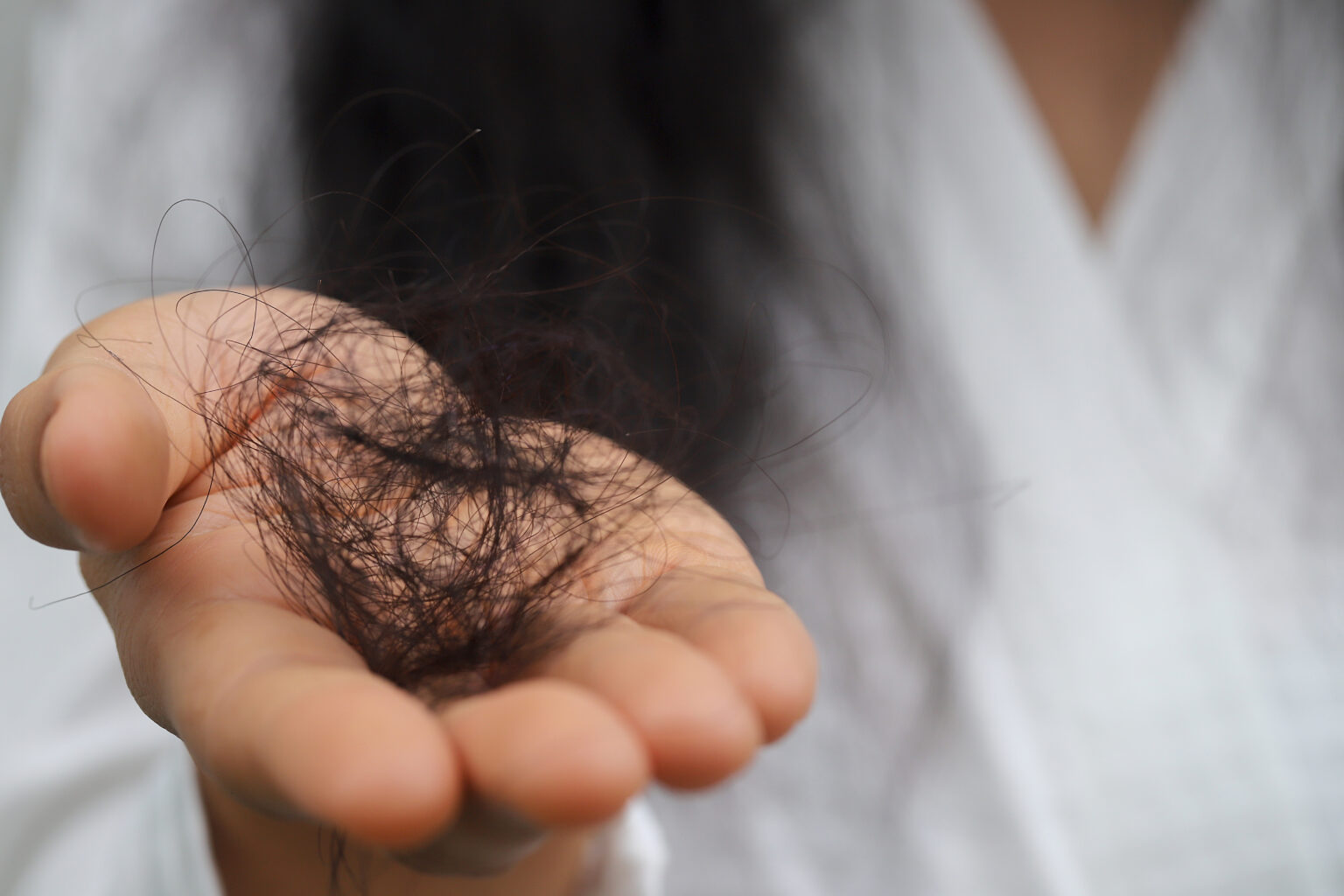 Hair Loss Disease: Medical Conditions That Can Cause Hair Loss