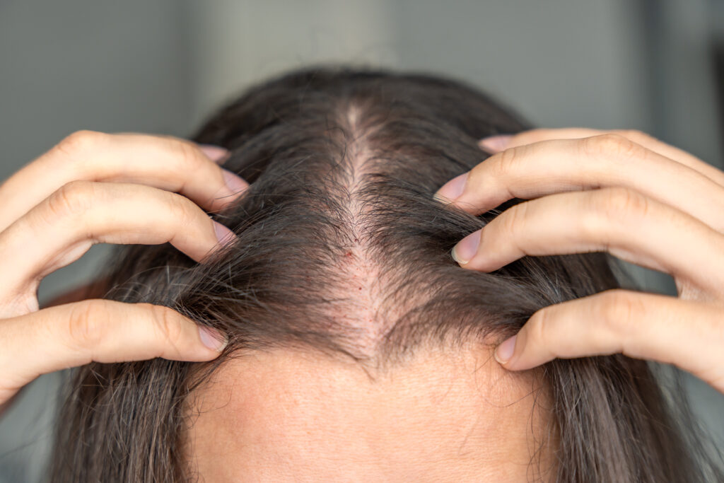 Person parting their hair in the mirror, checking the widened part line for early signs of hair loss.