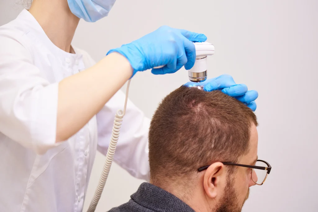 Trichologist using a specialized scanner to detect micro signs of hair loss on a male patient's scalp.