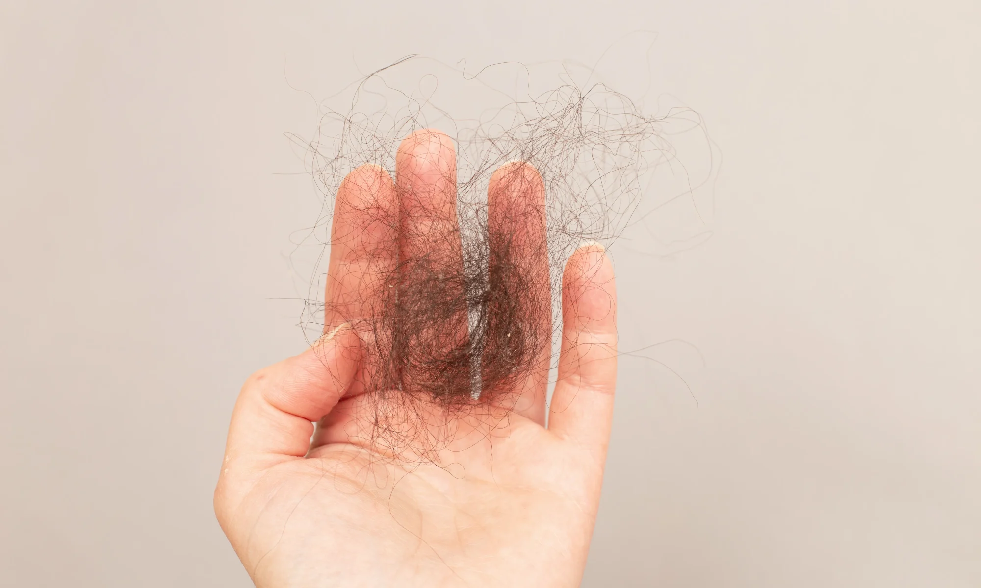 Close-up of a person holding a hand full of fallen dark hair, asking "why am I losing so much hair?".