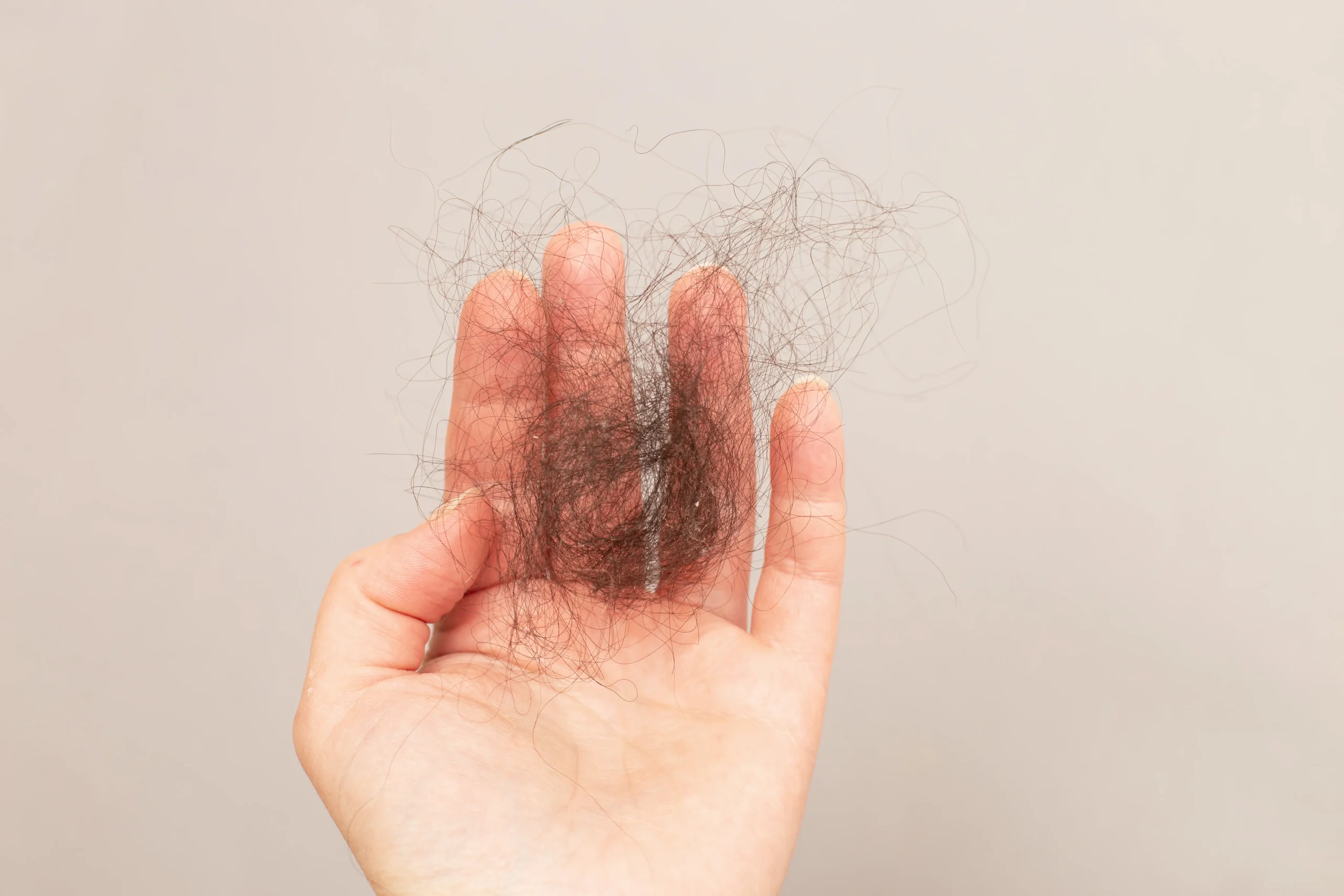 Close-up of a person holding a hand full of fallen dark hair, asking "why am I losing so much hair?".
