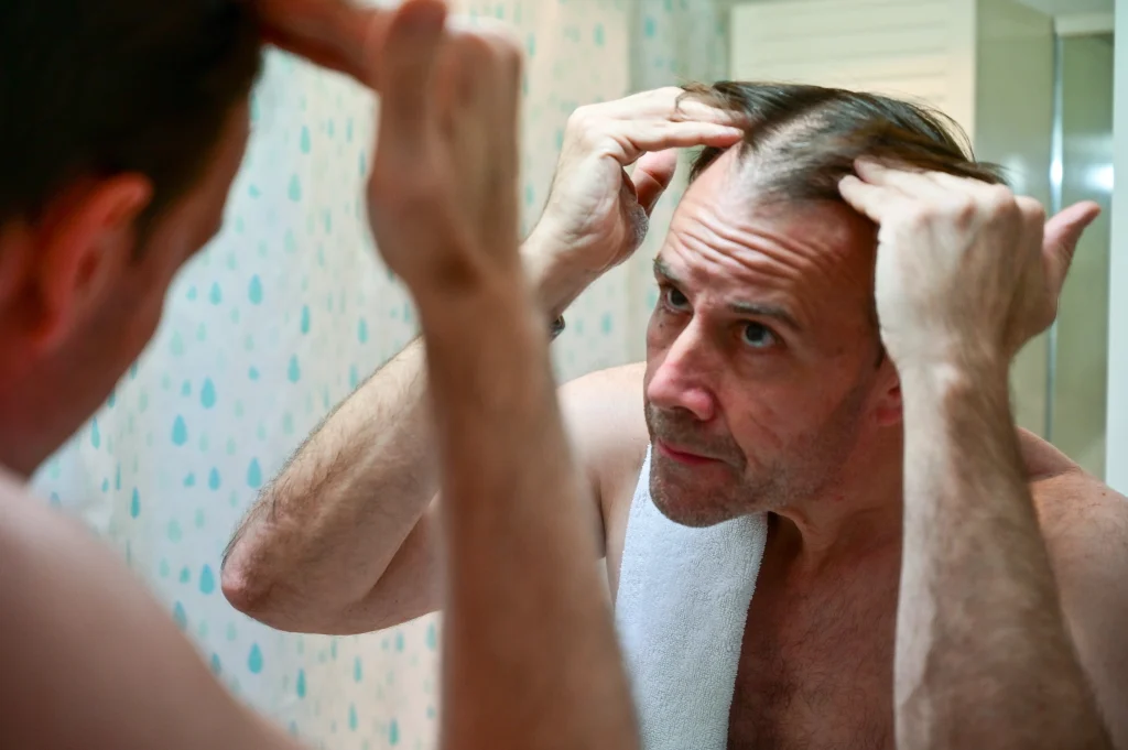 A man looks distressed at his reflection, inspecting his receding hairline and wondering "why am I losing so much hair?".