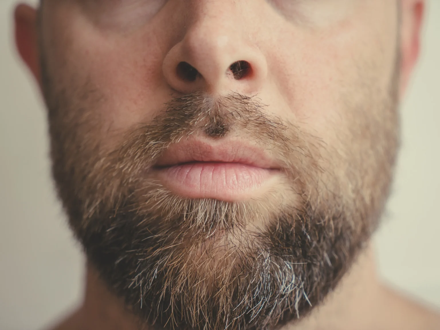 How Much Does a Beard Transplant Cost in Mexico?