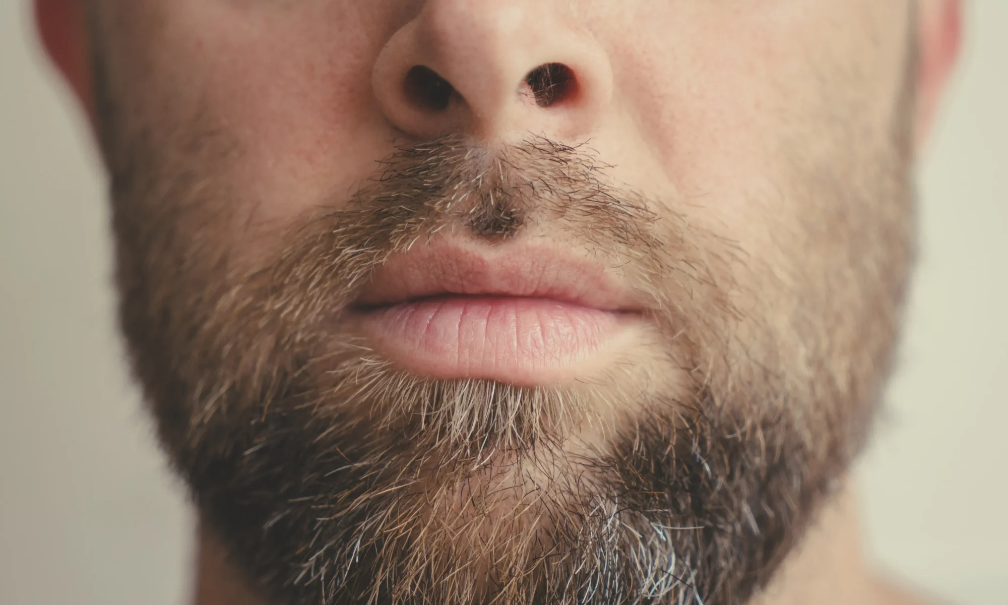 Close-up of a man with a thick, well-groomed full beard after discussing affordable beard transplant cost in Mexico.