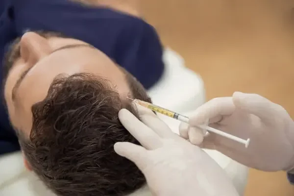 oung man receiving PRP scalp treatment at a clinic as a safe solution for density loss in crown and hairline areas