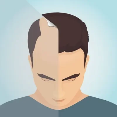 Concept image showing half of a head bald and the other half with thick hair, visualizing treatment impact for various types of alopecia conditions