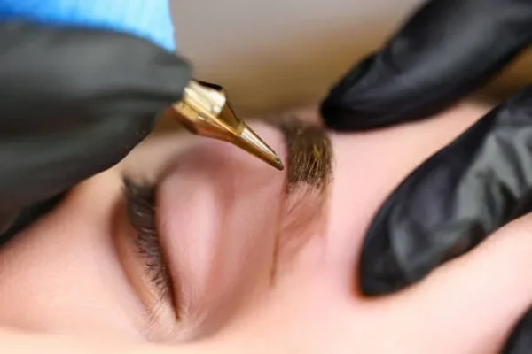 Cosmetic procedure on eyebrows involving scalp micropigmentation for restoring density and achieving a fuller natural brow look.